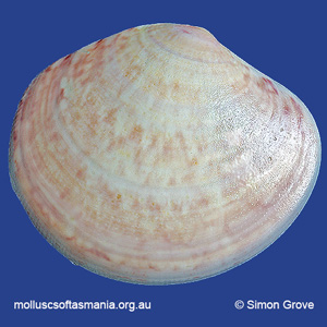 Sunetta vaginalis